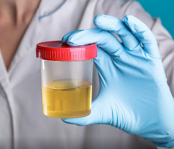 Urinabgabe - Kurzfristiger Nachweis